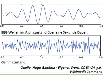 EEG-Wellen im Alphazustand über eine Sekunde Dauer. Gammazustand darunter.